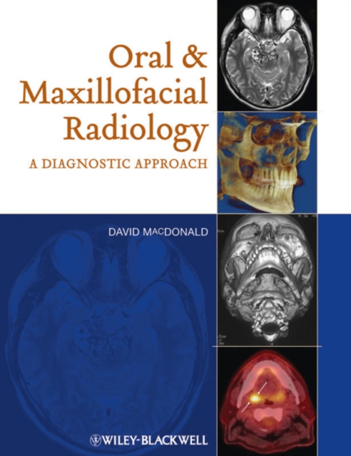 Oral and Maxillofacial Radiology : A Diagnostic Approach, EPUB eBook