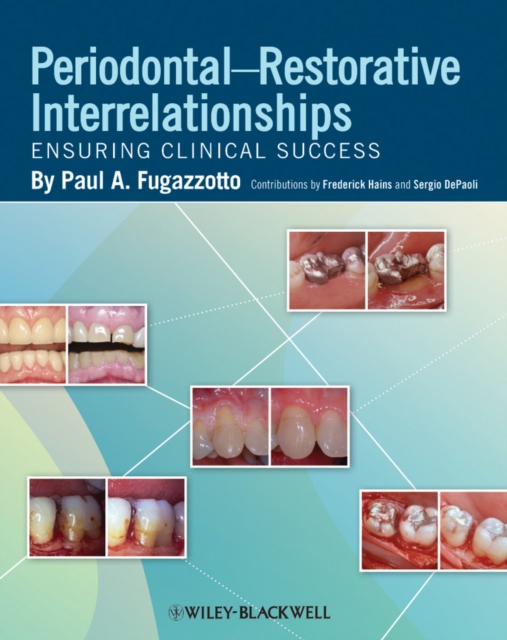 Periodontal-Restorative Interrelationships : Ensuring Clinical Success, EPUB eBook