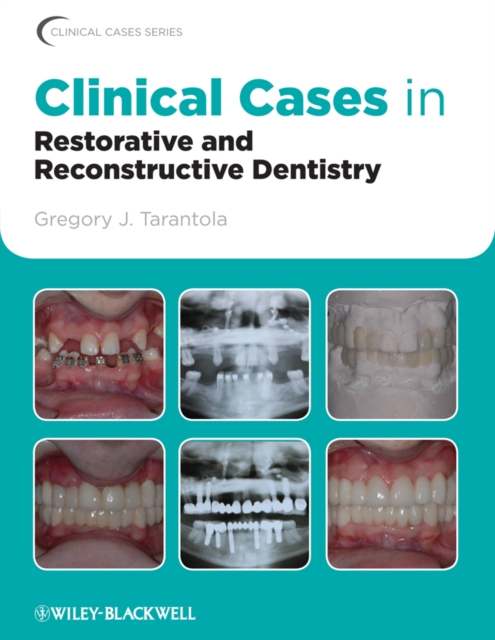 Clinical Cases in Restorative and Reconstructive Dentistry, EPUB eBook