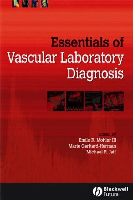Essentials of Vascular Laboratory Diagnosis, PDF eBook