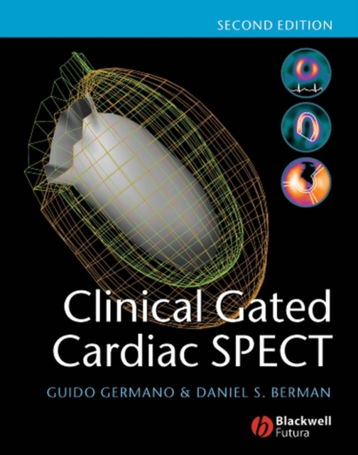 Clinical Gated Cardiac SPECT, PDF eBook