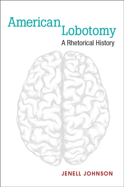 American Lobotomy : A Rhetorical History, Hardback Book