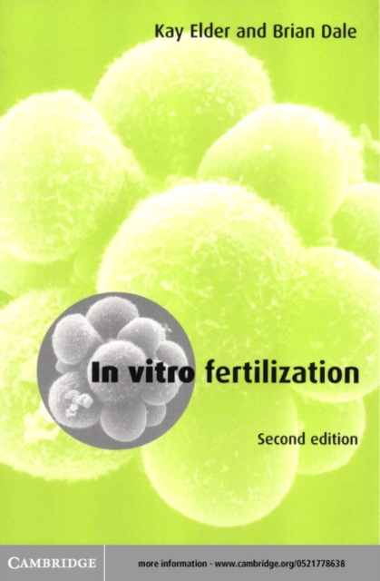 In Vitro Fertilization, PDF eBook