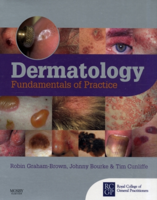 Dermatology : Diseases and Therapy, PDF eBook