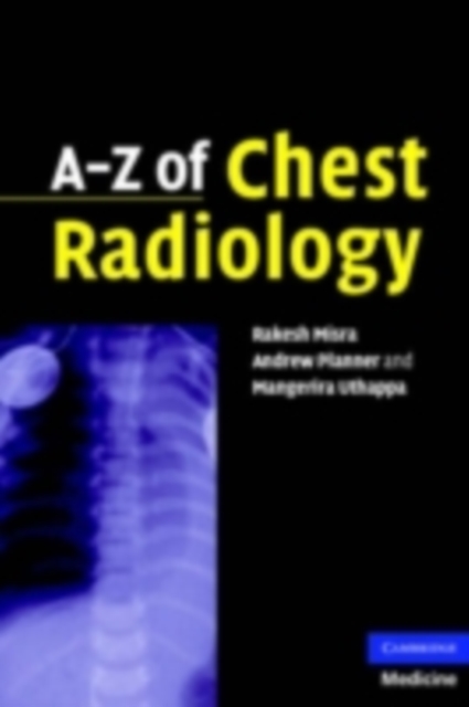 A-Z of Chest Radiology, PDF eBook