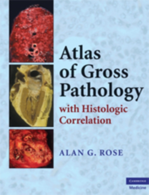 Atlas of Gross Pathology : With Histologic Correlation, PDF eBook