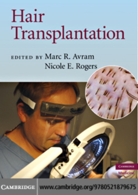 Hair Transplantation, PDF eBook
