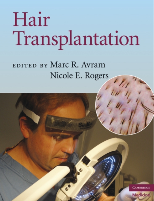 Hair Transplantation, EPUB eBook