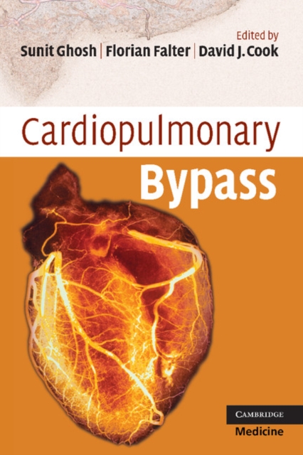 Cardiopulmonary Bypass, EPUB eBook