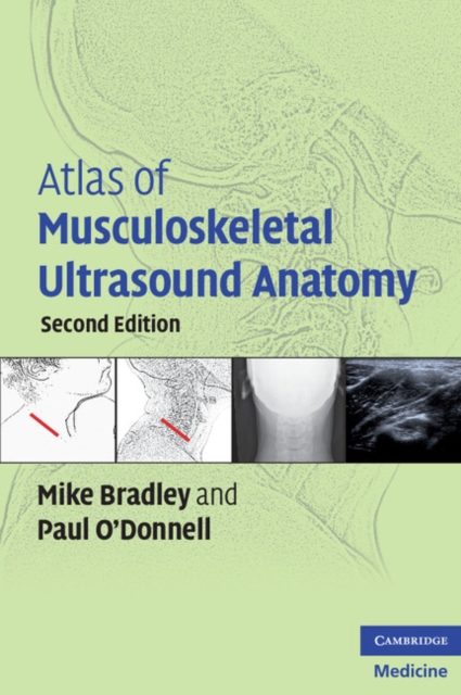 Atlas of Musculoskeletal Ultrasound Anatomy, EPUB eBook