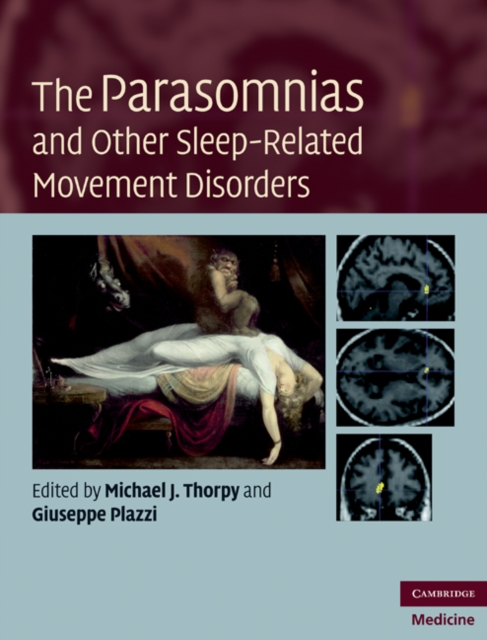 Parasomnias and Other Sleep-Related Movement Disorders, EPUB eBook