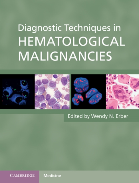 Diagnostic Techniques in Hematological Malignancies, EPUB eBook