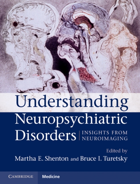 Understanding Neuropsychiatric Disorders : Insights from Neuroimaging, EPUB eBook