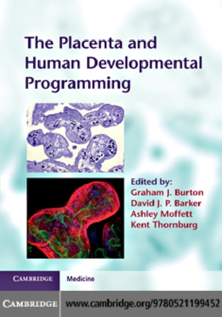 Placenta and Human Developmental Programming, PDF eBook