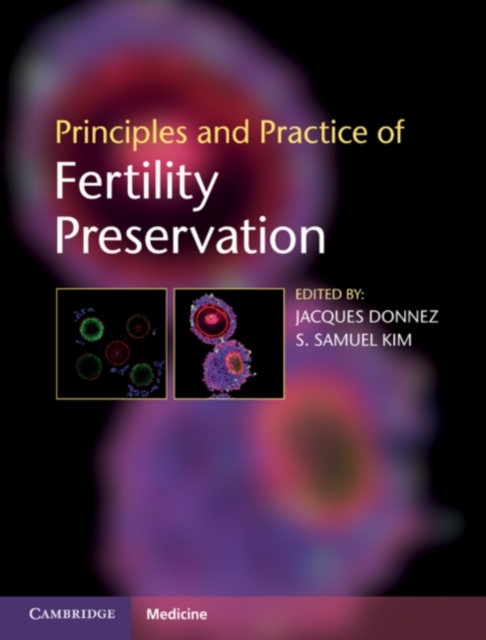Principles and Practice of Fertility Preservation, PDF eBook