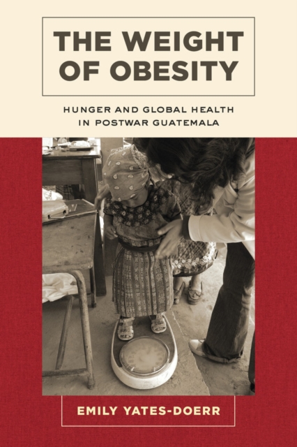 The Weight of Obesity : Hunger and Global Health in Postwar Guatemala, Paperback / softback Book