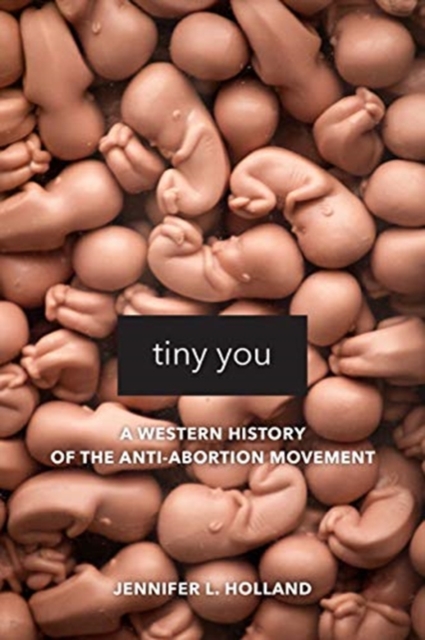 Tiny You : A Western History of the Anti-Abortion Movement, Hardback Book