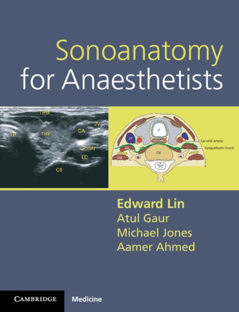 Sonoanatomy for Anaesthetists, Spiral bound Book