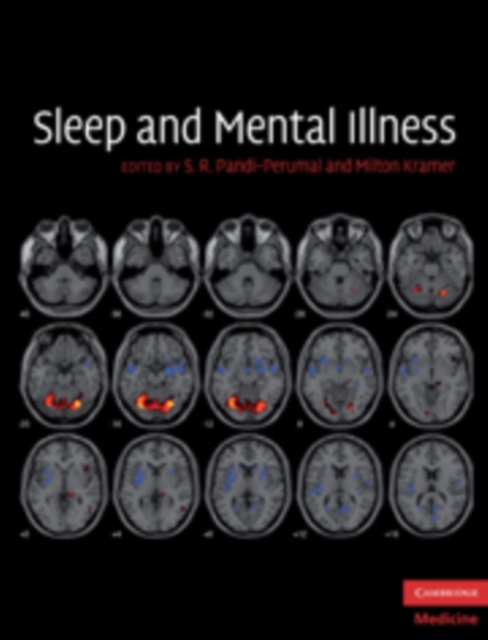 Sleep and Mental Illness, Hardback Book