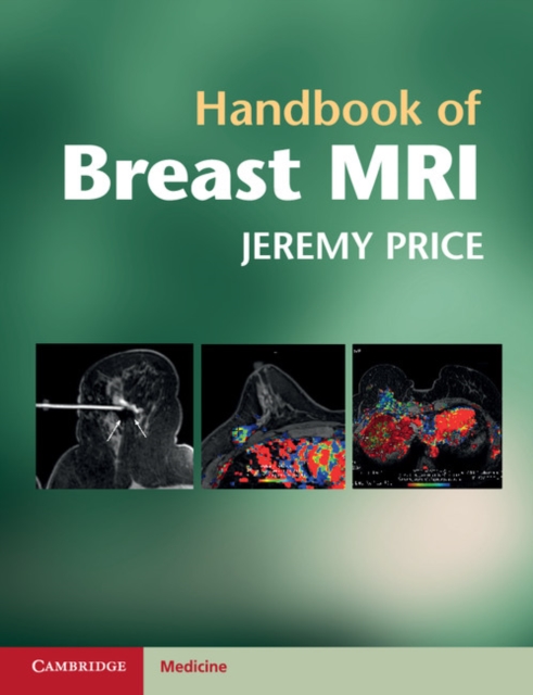 Handbook of Breast MRI, Paperback / softback Book
