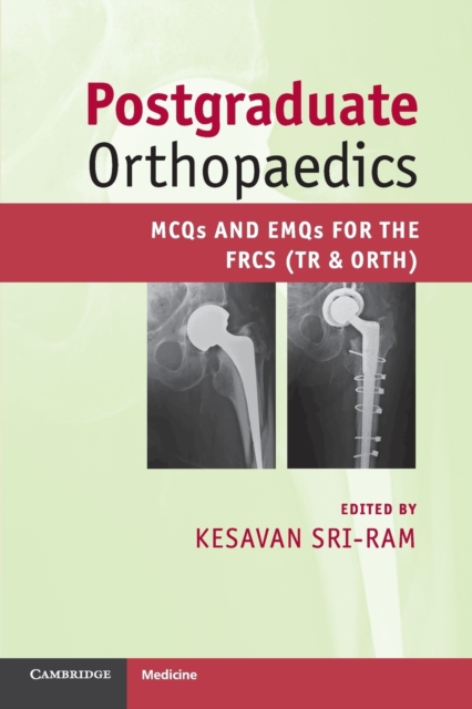 Postgraduate Orthopaedics : MCQs and EMQs for the FRCS (Tr & Orth), Paperback / softback Book