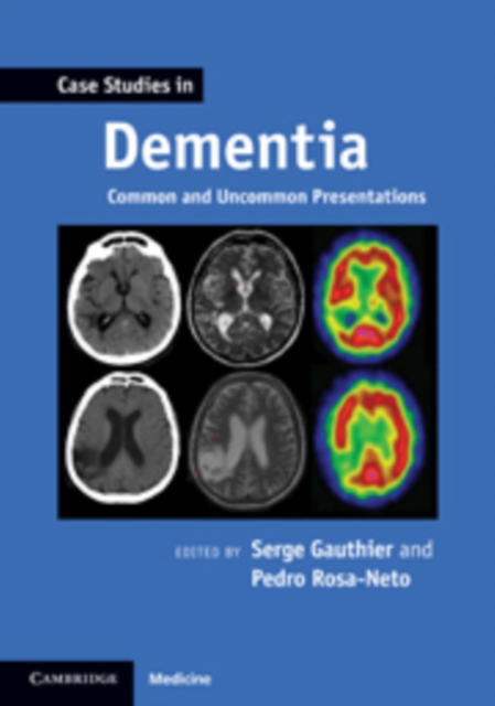 Case Studies in Dementia: Volume 1 : Common and Uncommon Presentations, Paperback / softback Book