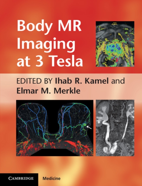 Body MR Imaging at 3 Tesla, Hardback Book