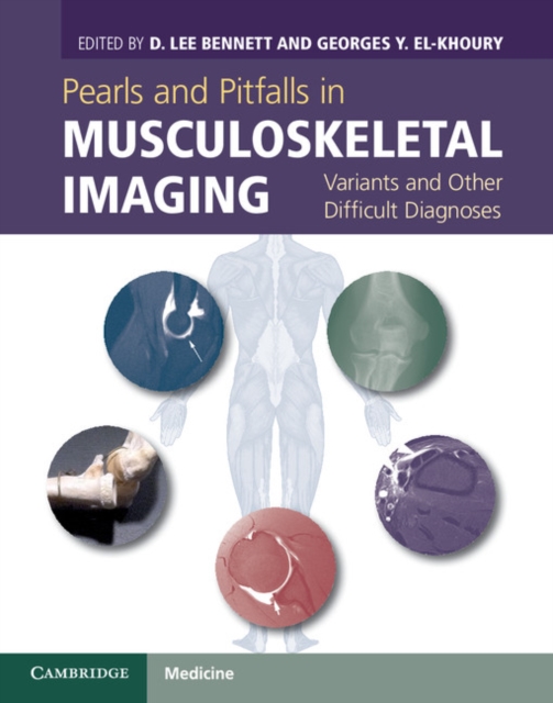 Pearls and Pitfalls in Musculoskeletal Imaging : Variants and Other Difficult Diagnoses, Hardback Book