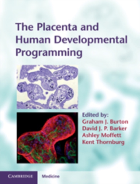 The Placenta and Human Developmental Programming, Hardback Book