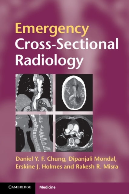 Emergency Cross-sectional Radiology, Paperback / softback Book