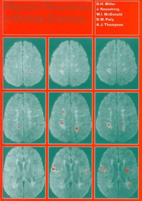 Magnetic Resonance in Multiple Sclerosis, Hardback Book