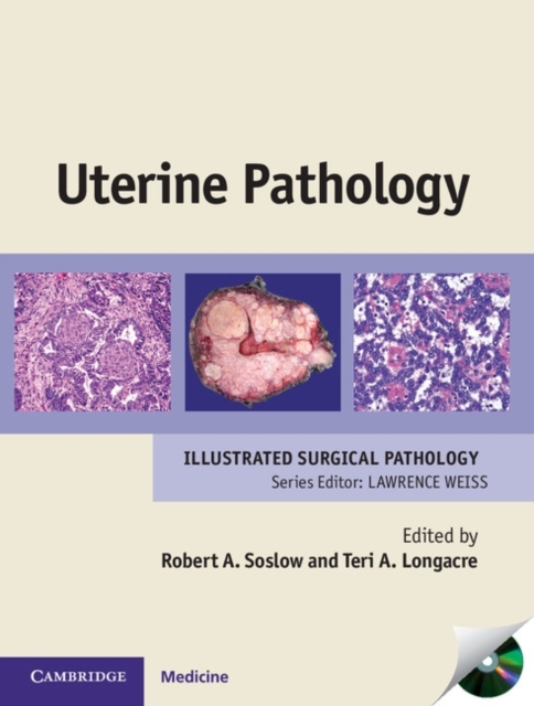 Uterine Pathology, Hardback Book