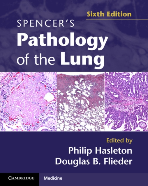 Spencer's Pathology of the Lung 2 Part Set with DVDs, Multiple-component retail product Book