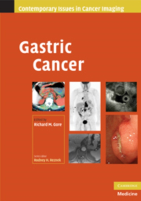 Gastric Cancer, Hardback Book