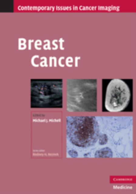 Breast Cancer, Hardback Book