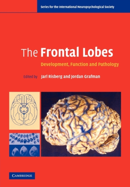 The Frontal Lobes : Development, Function and Pathology, Paperback / softback Book