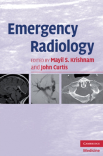 Emergency Radiology, Paperback / softback Book