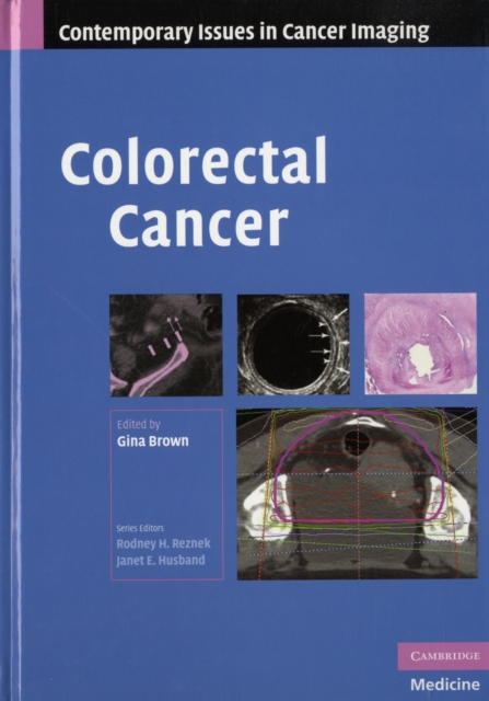 Colorectal Cancer, Hardback Book