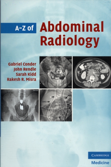 A-Z of Abdominal Radiology, Paperback / softback Book