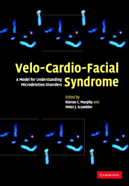 Velo-Cardio-Facial Syndrome : A Model for Understanding Microdeletion Disorders, Hardback Book