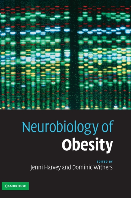 Neurobiology of Obesity, Hardback Book