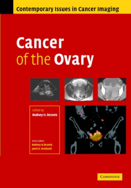Cancer of the Ovary, Hardback Book