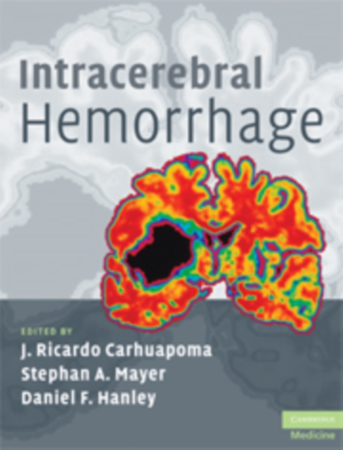 Intracerebral Hemorrhage, Hardback Book