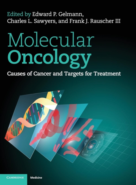 Molecular Oncology : Causes of Cancer and Targets for Treatment, Hardback Book