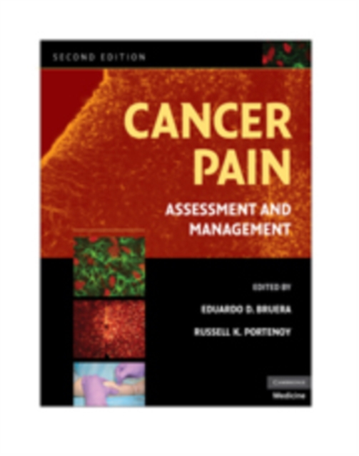 Cancer Pain : Assessment and Management, Hardback Book