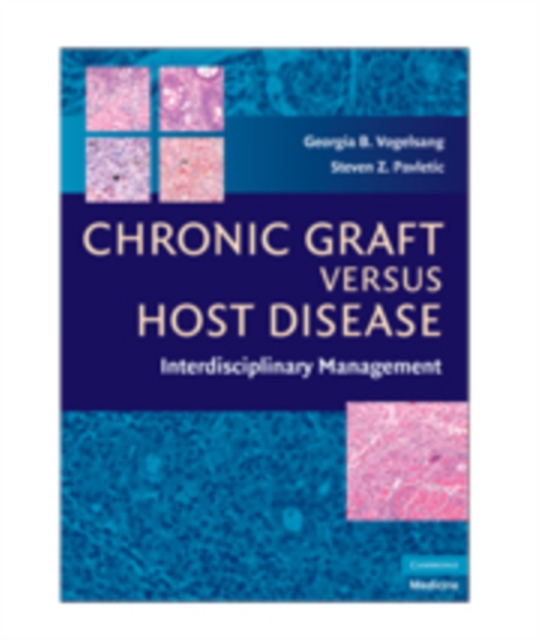 Chronic Graft Versus Host Disease : Interdisciplinary Management, Hardback Book