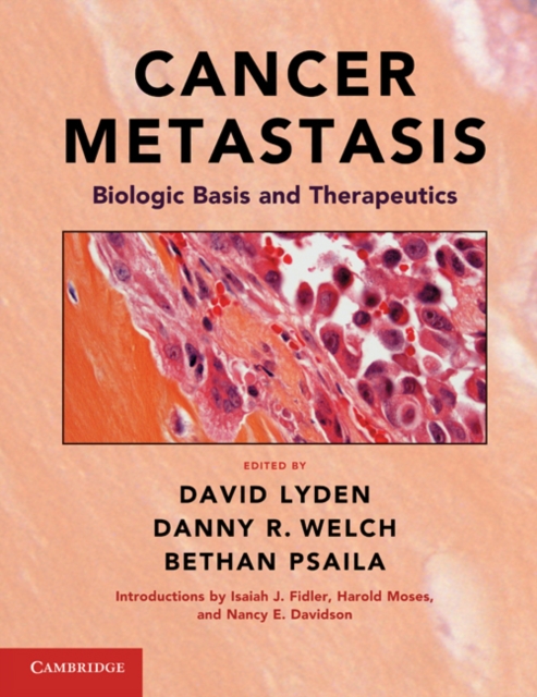 Cancer Metastasis : Biologic Basis and Therapeutics, Hardback Book