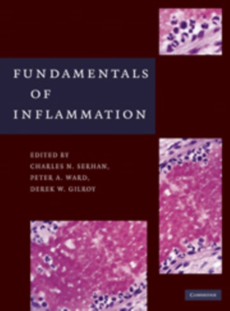 Fundamentals of Inflammation, Hardback Book