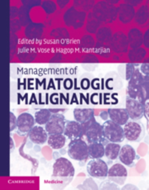 Management of Hematologic Malignancies, Hardback Book