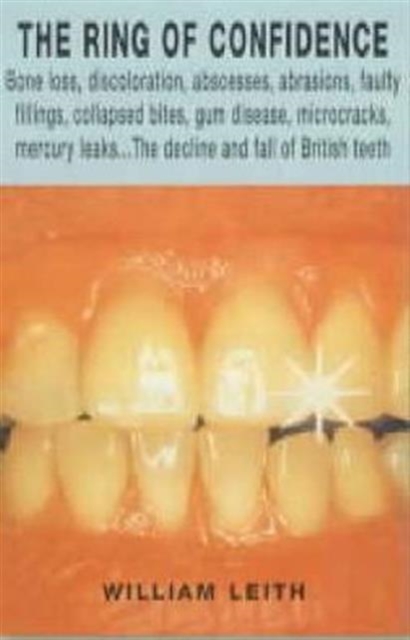 British Teeth, Paperback / softback Book
